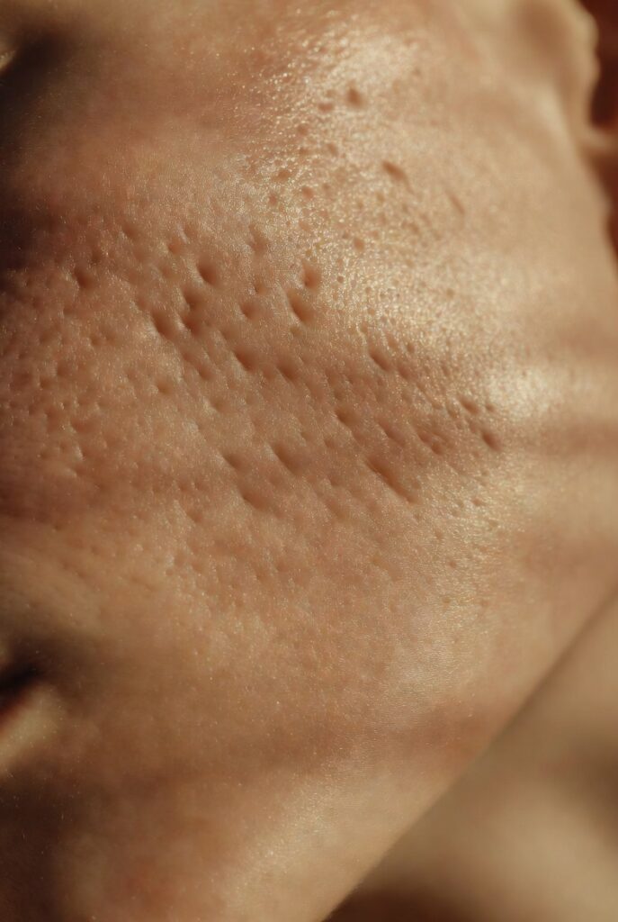 Supports a Stronger Skin Barrier