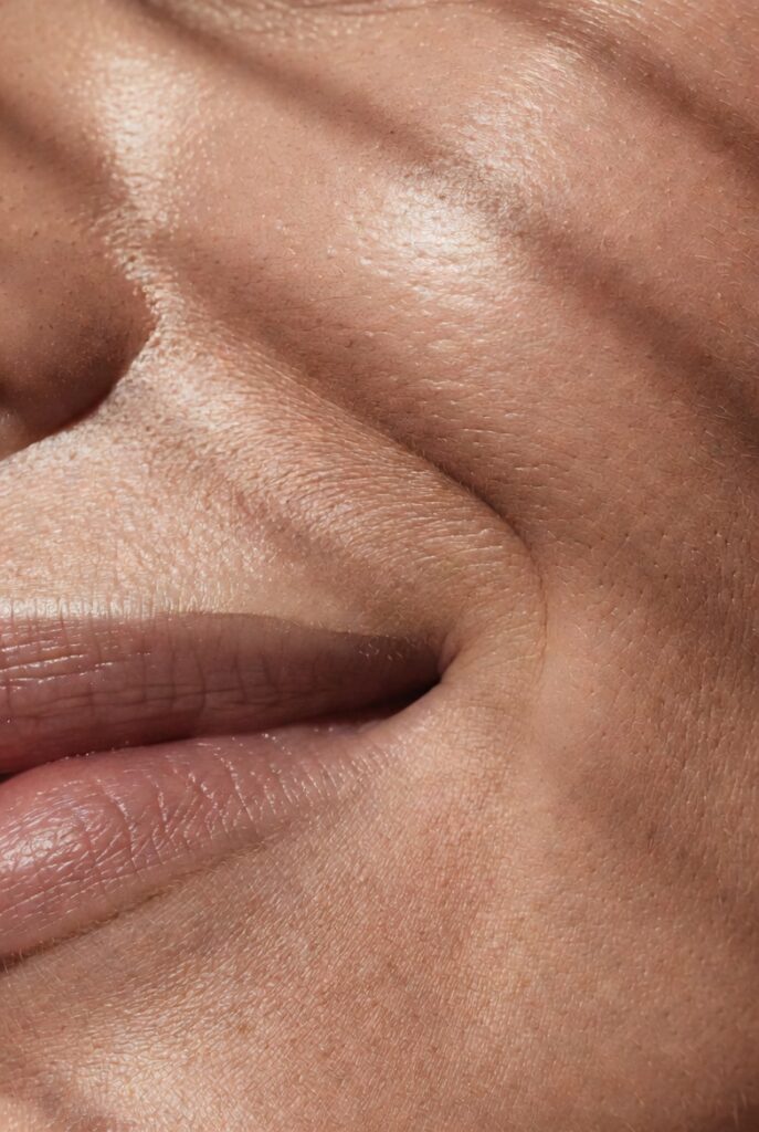 Smile Line and Nasolabial Fold Concealer